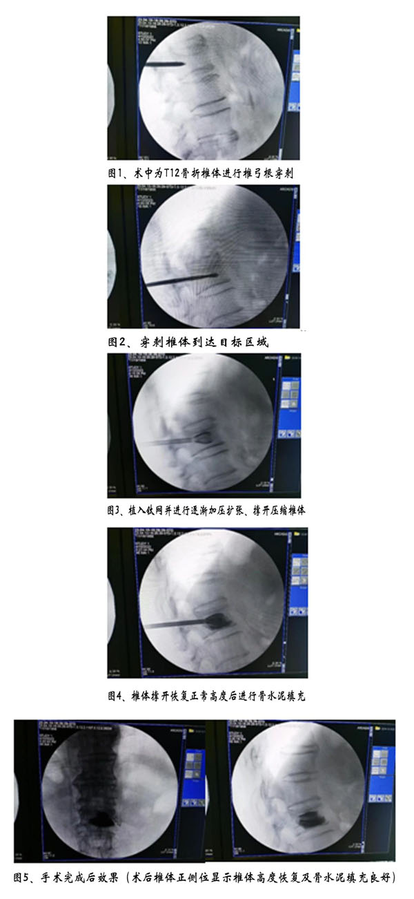 1681800738145394.jpg 微信圖片_20230418144553.jpg