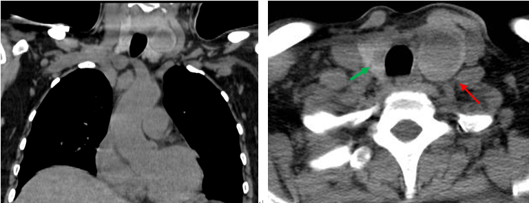 1688713774785203.png 640 (3).png