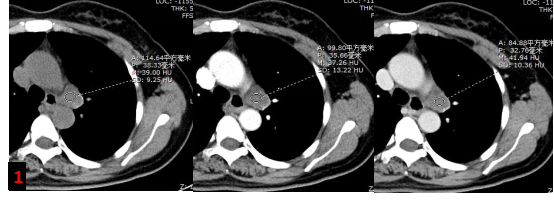 1697506160160177.png 640.png