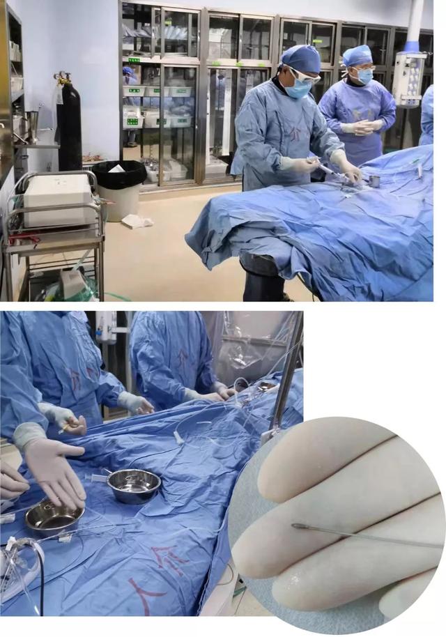 我院心內科成功開展我市首例冠狀動脈旋磨術與血管內超聲檢測技術